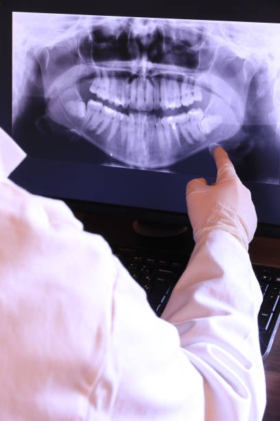 Best Emergency Dental Care for Sports Injuries in Tazewell, TN